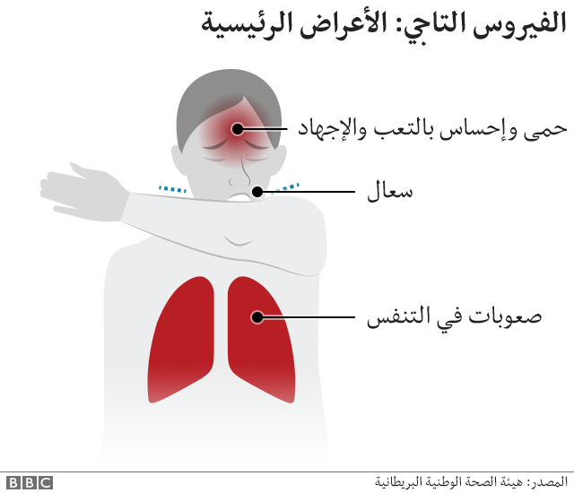 الأعراض الأساسية لفيروس كورونا: ارتفاع درجة الحرارة، سعال، وصعوبة التنفس. 